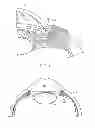 Fig. 02 - Delivery system for ocular implant