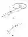Fig. 03 - Delivery system for ocular implant