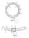 Fig. 04 - Catheter deflection anchor