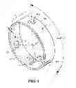 Fig. 05 - Catheter deflection anchor