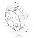Fig. 06 - Catheter deflection anchor