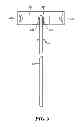Fig. 08 - Catheter deflection anchor