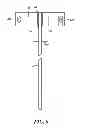 Fig. 09 - Catheter deflection anchor