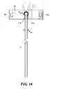 Fig. 10 - Catheter deflection anchor