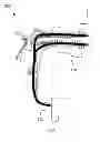 Fig. 01 - MULTI-DIRECTIONAL NEEDLE