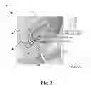 Fig. 03 - MULTI-DIRECTIONAL NEEDLE