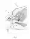 Fig. 05 - MULTI-DIRECTIONAL NEEDLE