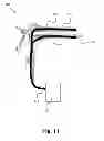 Fig. 12 - MULTI-DIRECTIONAL NEEDLE