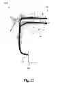 Fig. 13 - MULTI-DIRECTIONAL NEEDLE