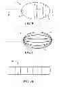 Fig. 07 - METHOD FOR TREATMENT OF VT USING ABLATION