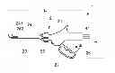 Fig. 01 - MICROWAVE SURGICAL TOOL