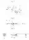 Fig. 02 - MICROWAVE SURGICAL TOOL