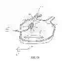 Fig. 08 - CIRCUMFERENTIAL ABLATION DEVICE ASSEMBLY