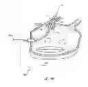 Fig. 09 - CIRCUMFERENTIAL ABLATION DEVICE ASSEMBLY