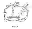 Fig. 12 - CIRCUMFERENTIAL ABLATION DEVICE ASSEMBLY