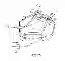 Fig. 14 - CIRCUMFERENTIAL ABLATION DEVICE ASSEMBLY