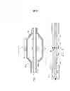 Fig. 17 - CIRCUMFERENTIAL ABLATION DEVICE ASSEMBLY
