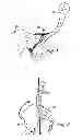 Fig. 02 - Sacroiliac joint immobilization