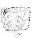 Fig. 03 - Sacroiliac joint immobilization