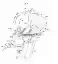 Fig. 05 - Methods and devices for ligament repair