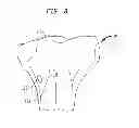 Fig. 08 - Methods and devices for ligament repair