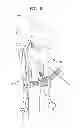 Fig. 10 - Methods and devices for ligament repair