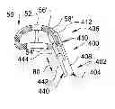 Fig. 01 - INSTRUMENTS AND METHODS FOR SPINAL IMPLANT REVISION
