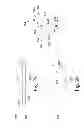 Fig. 10 - INSTRUMENTS AND METHODS FOR SPINAL IMPLANT REVISION