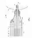 Fig. 02 - Method for using microelectromechanical systems to generate movement in a phacoemulsification handpiece