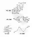 Fig. 49 - Endoluminal filter