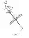 Fig. 04 - WOUND CLOSURE DEVICE INCLUDING SUCTION STEP SLEEVE