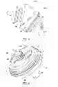 Fig. 02 - Glenoid implant