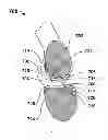 Fig. 01 - Method for modifying the wettability and other biocompatibility characteristics of a surface of a biological material by the application of beam technology and biological materials made thereby