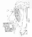 Fig. 02 - Remotely Controlled Surgical Robots