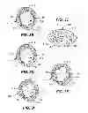 Fig. 03 - ANTI-SLIP SCRUBBER BRUSH AND ASSEMBLY METHODS