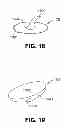 Fig. 09 - Apparatus and kit for interchanging button designs on apparel and other goods