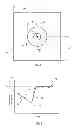 Fig. 04 - Method and apparatus for measuring a property of an eye of a subject
