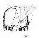Fig. 02 - Method for determining at least one applicable path of movement for an object in tissue