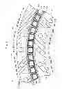 Fig. 06 - Thrust roller bearing