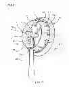 Fig. 02 - DOWN WIND FLUID TURBINE