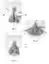 Fig. 06 - Reconfigurable doll