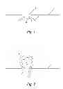 Fig. 02 - Low mass density surgical implant having strands and methods of use