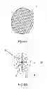 Fig. 08 - Low mass density surgical implant and methods of use