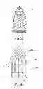 Fig. 09 - Low mass density surgical implant and methods of use