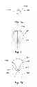 Fig. 10 - Low mass density surgical implant and methods of use