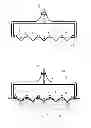 Fig. 01 - Method and system for invasive skin treatment