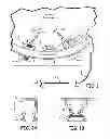 Fig. 02 - Magnetic-anchored robotic system