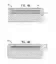 Fig. 06 - Vascular bands and delivery systems therefor