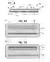 Fig. 09 - Vascular bands and delivery systems therefor