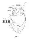 Fig. 05 - System and method of bladder and sphincter control